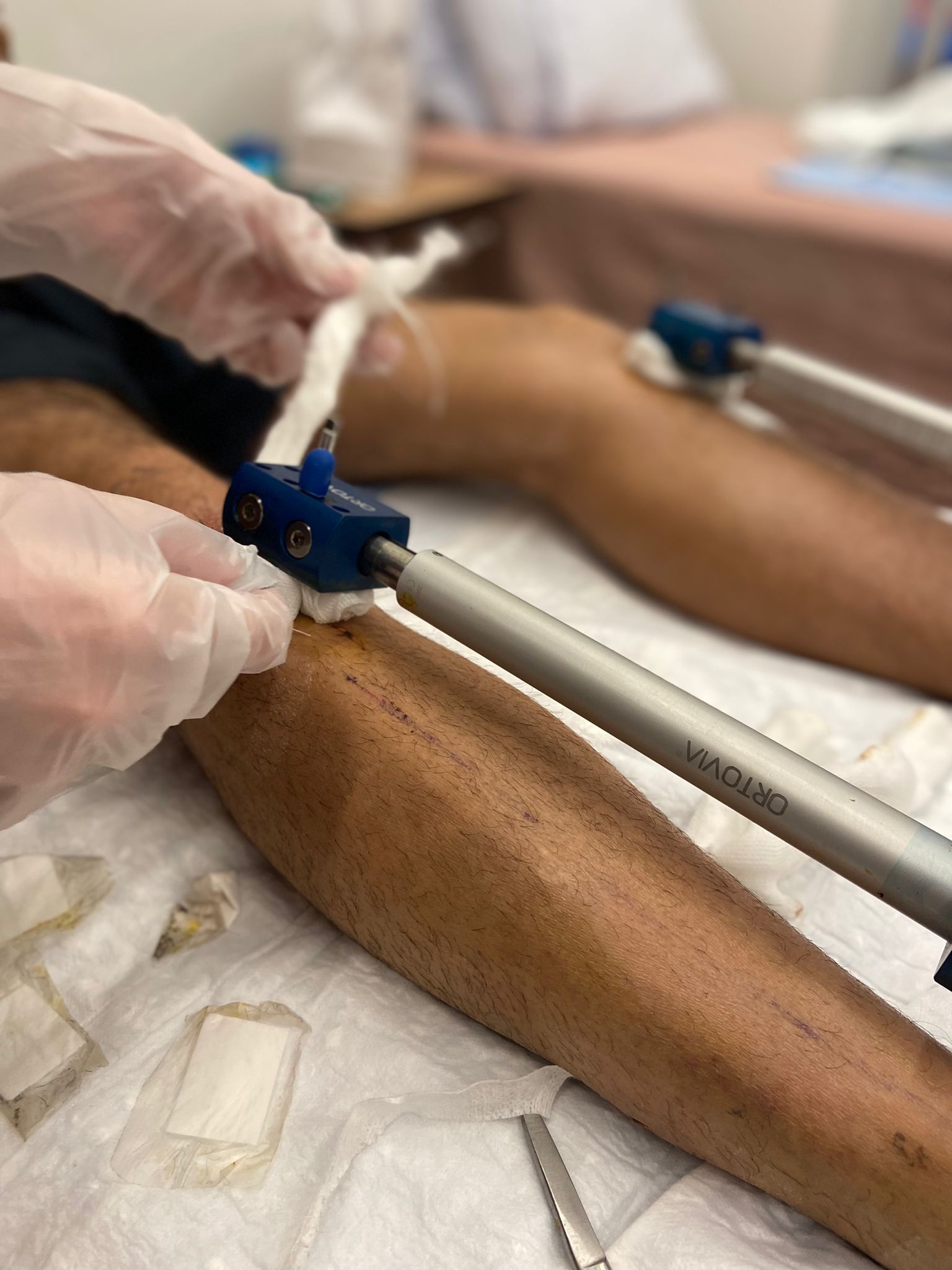 Do You Feel Pain during Medical Dressing